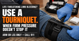 When Should I Use a Tourniquet in an Emergency?